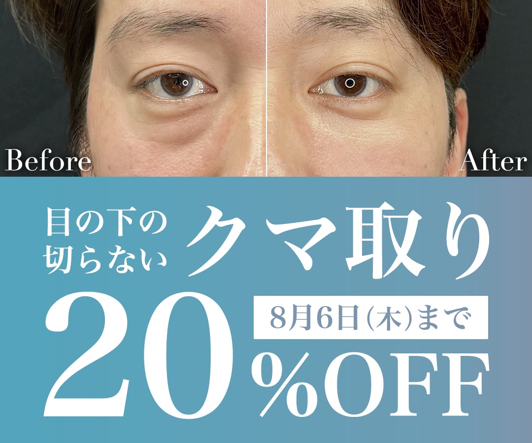 【クマ取り20%OFFキャンペーン】『目の下のクマ・たるみ取り』完全ガイド 大嶋美喜子医師が”若々しい目元”を叶えます