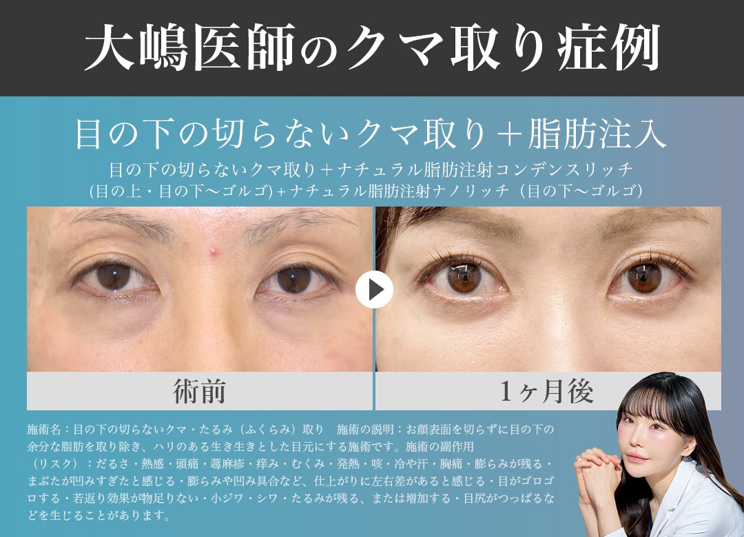 お疲れ顔解消で明るい目元へ