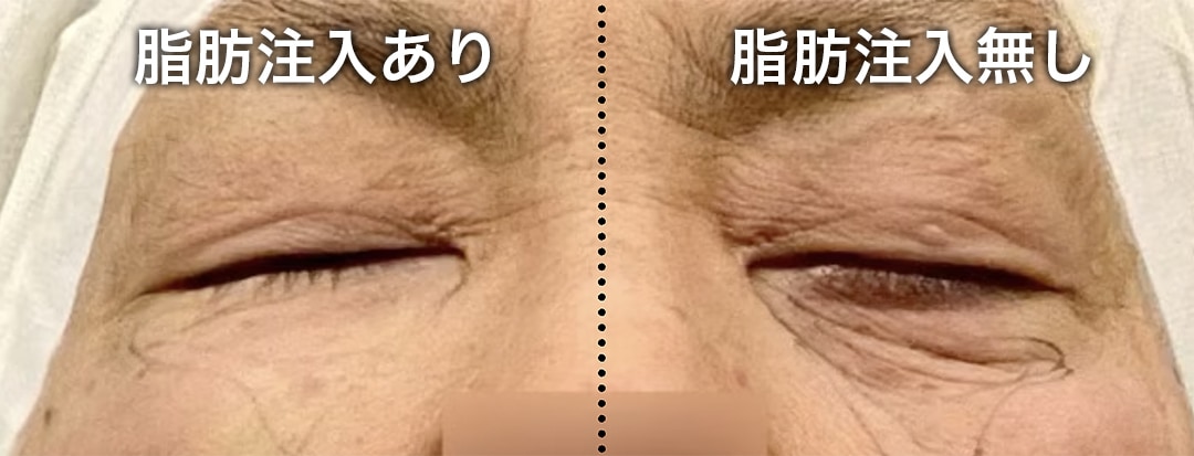 シワまで改善してより美しい仕上がりへ