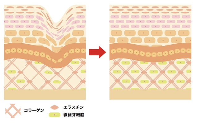 肌内部を再構築！ハリ弾力UP