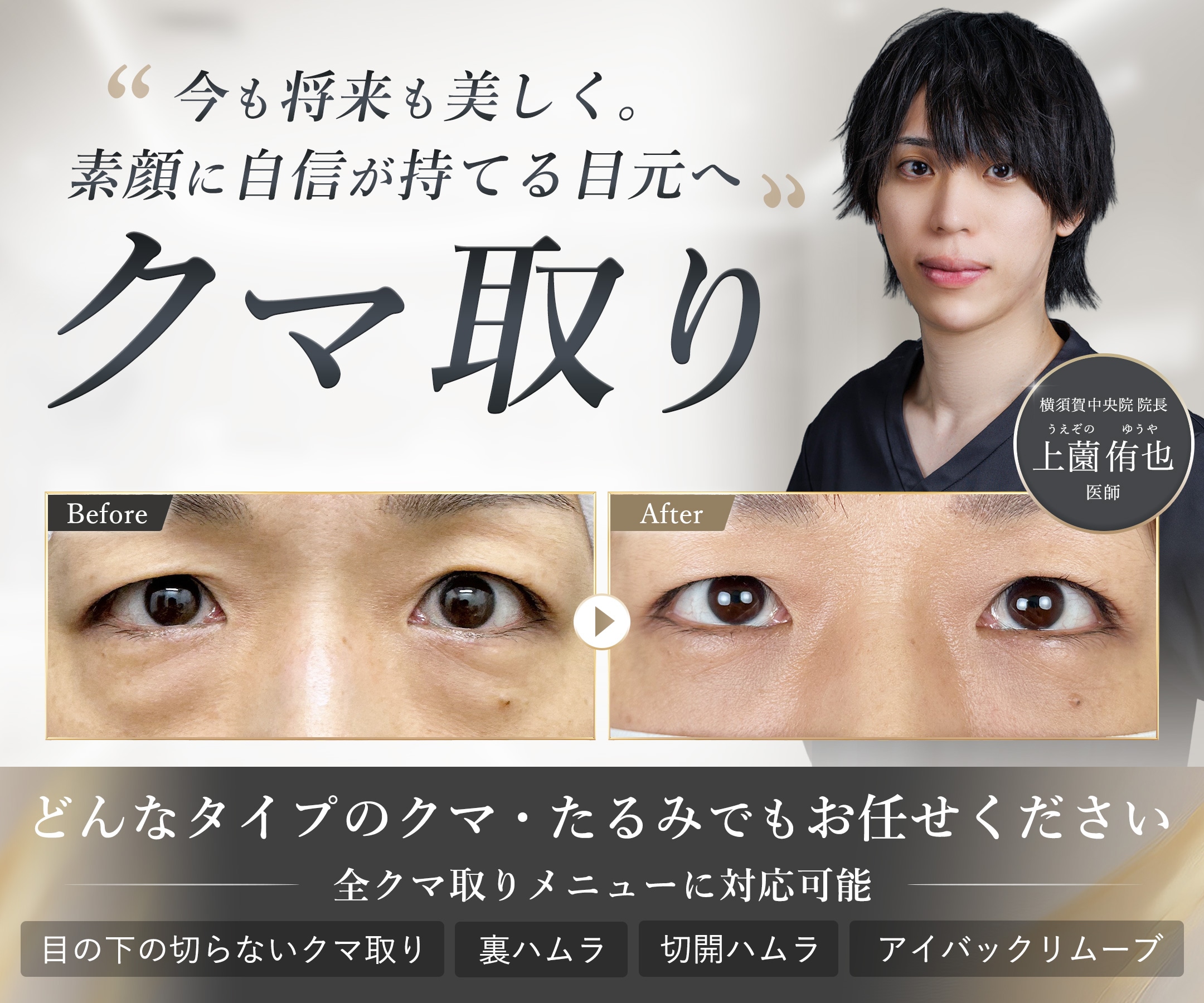 SBC湘南美容クリニック横須賀中央院。横須賀中央駅近くの美容整形・美容皮膚科です。圧倒的な実績を持つ上薗侑也医師によるクマ取り・二重整形。神奈川でクマ取り・二重整形をするなら上薗医師にお任せください。