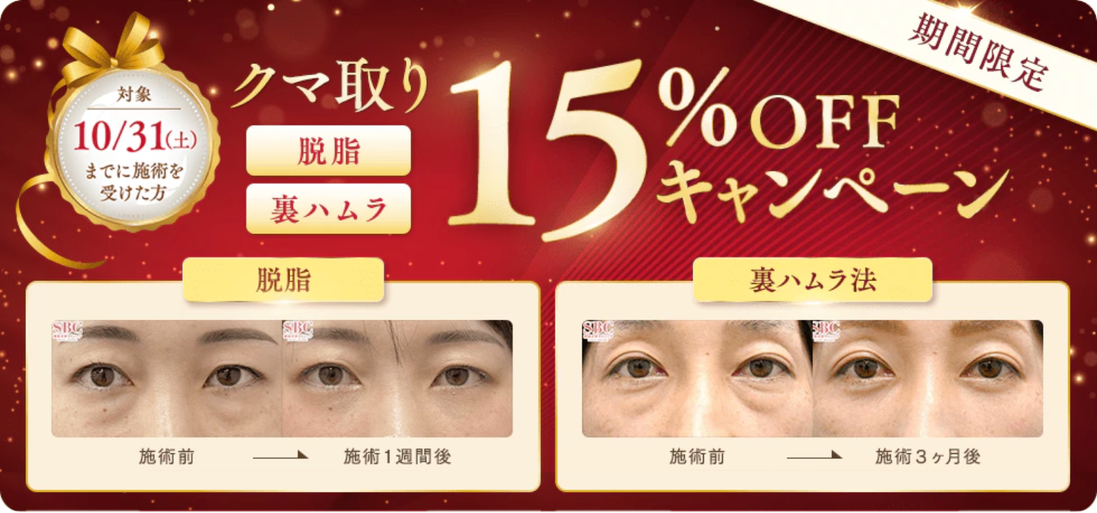 【10/31までがお得】クマ取りが今だけ最大50%OFF!!