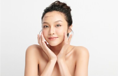 【糸リフト】従来よりリフトアップが約3倍！植田医師限定施術 ブルーローズリフト