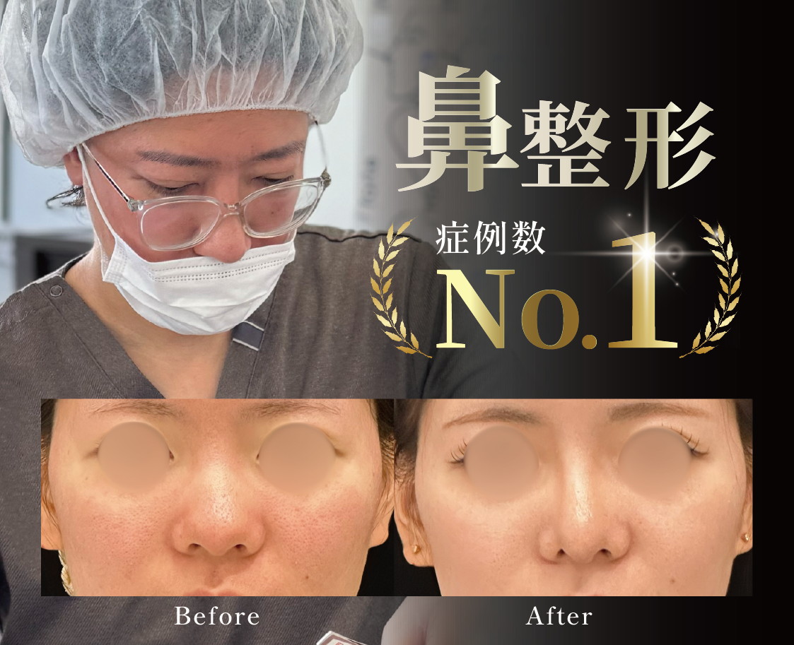 【鼻のプレミアムドクター】植田医師が叶える理想の美鼻