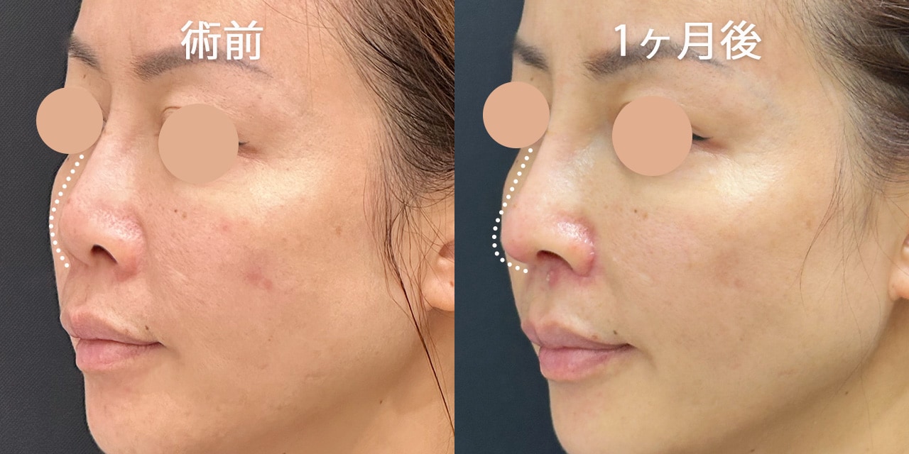 横顔美人をつくる黄金比のデザイン