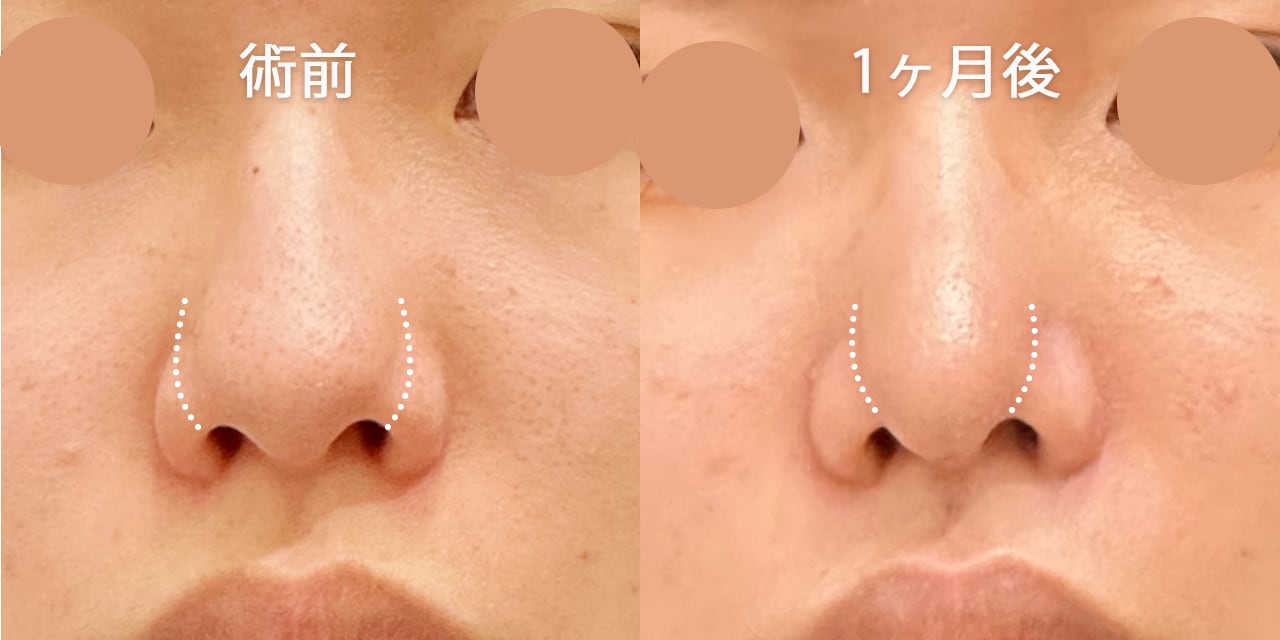 顔の中心バランスを整え、自然で上品な印象へ