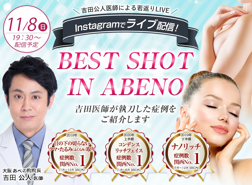 BEST SHOT IN ABENO