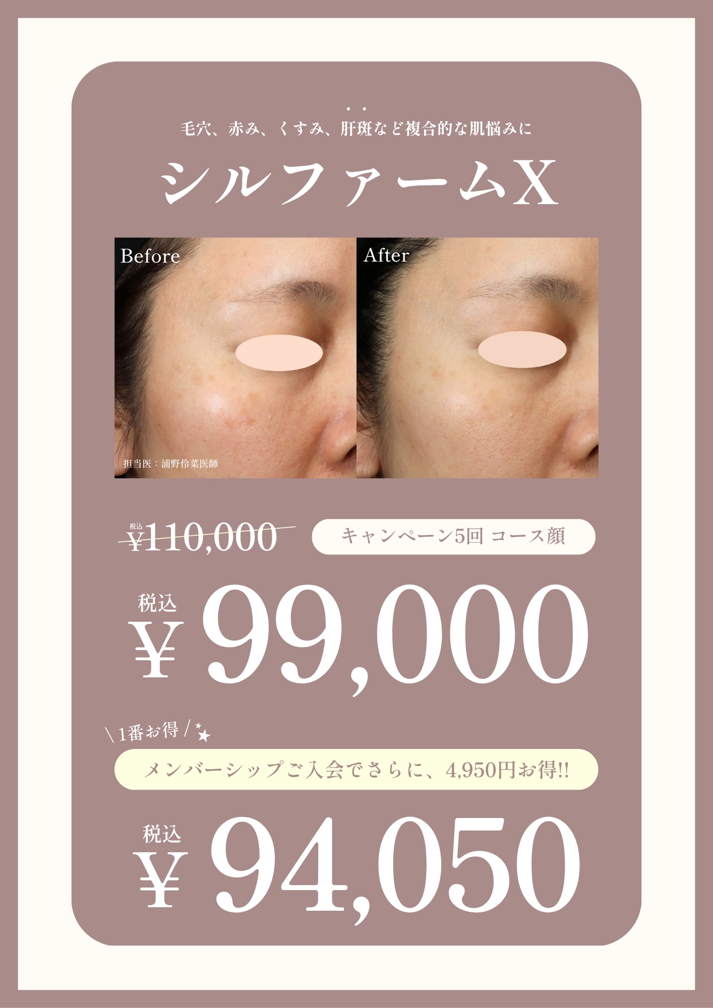 シルファームcp画像