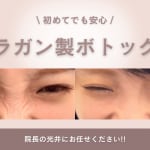 ボトックスサムネ画像