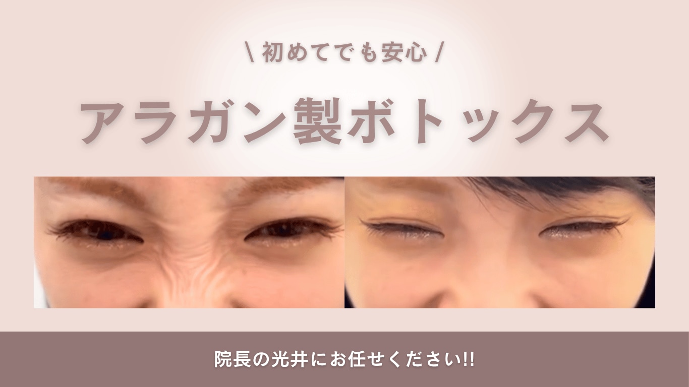 ボトックスサムネ画像