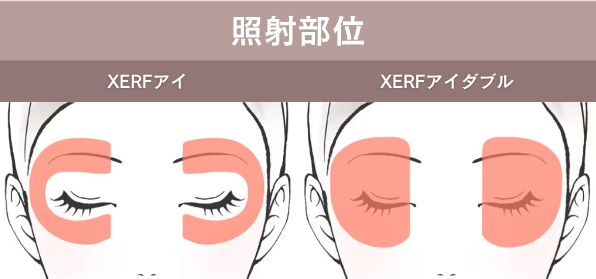 アイ照射部位画像
