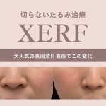 XERFのサムネ画像