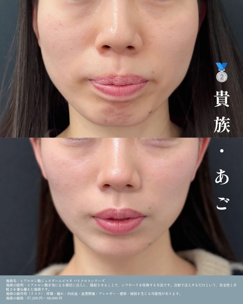 症例