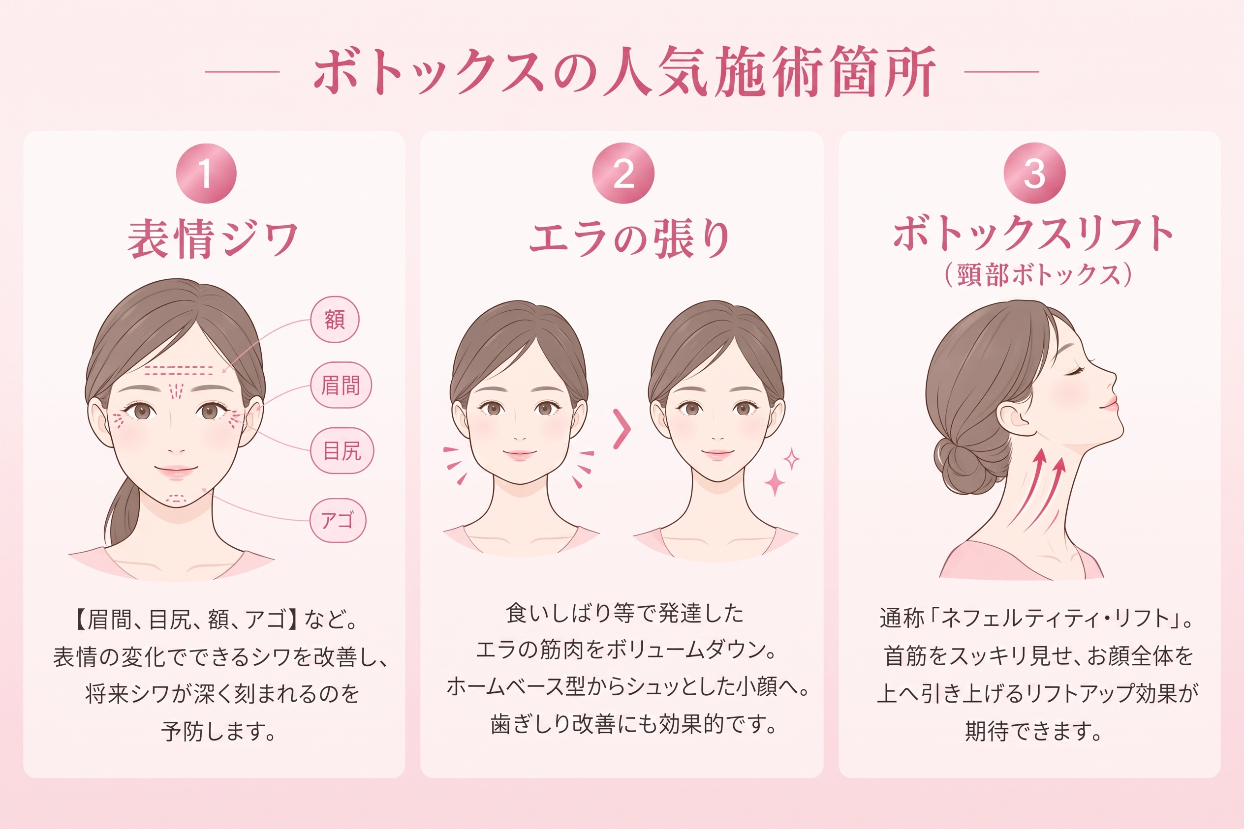 ボトックス人気施術箇所