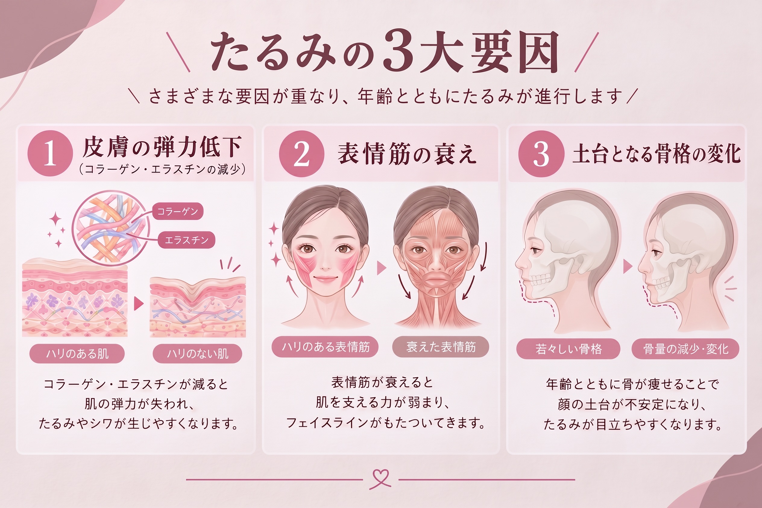 たるみの３大要素