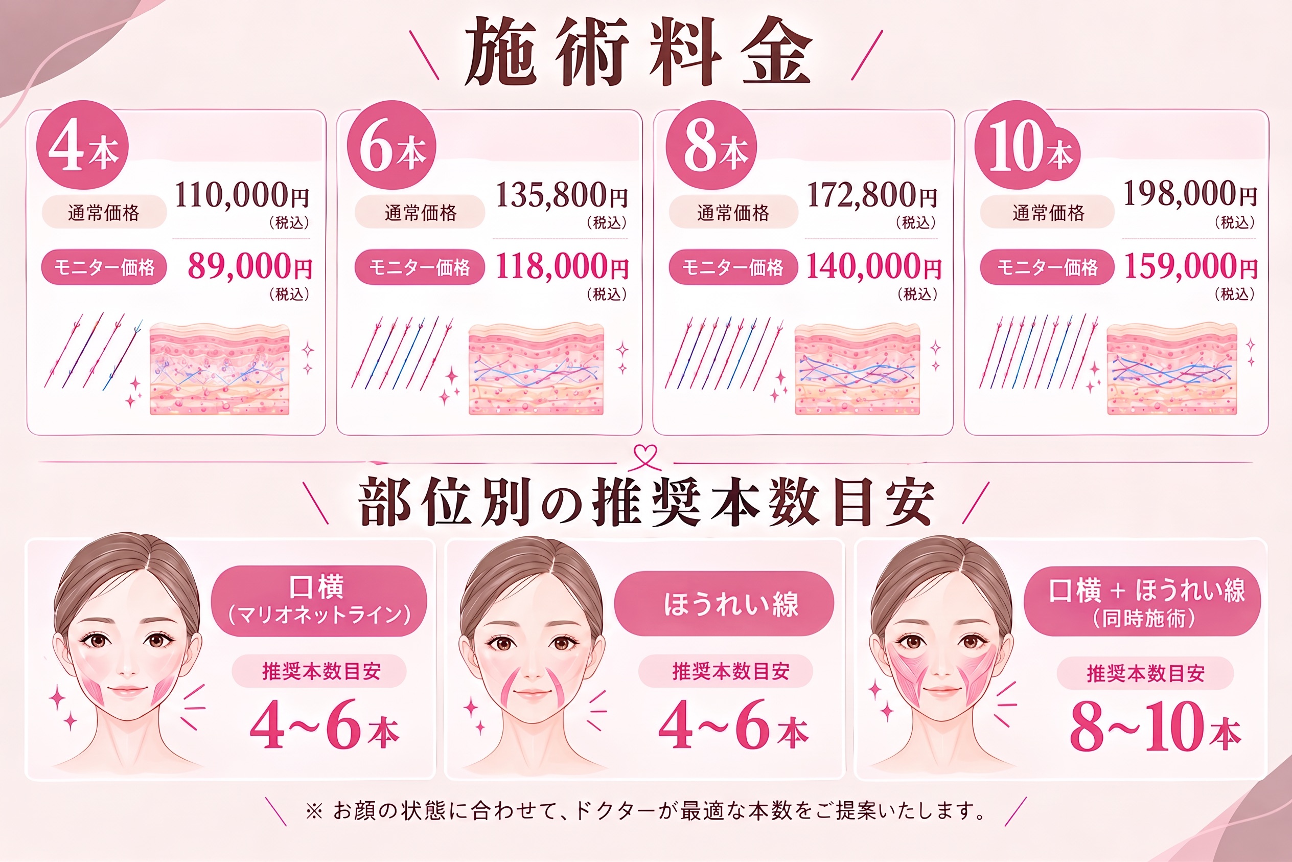 料金と推奨本数