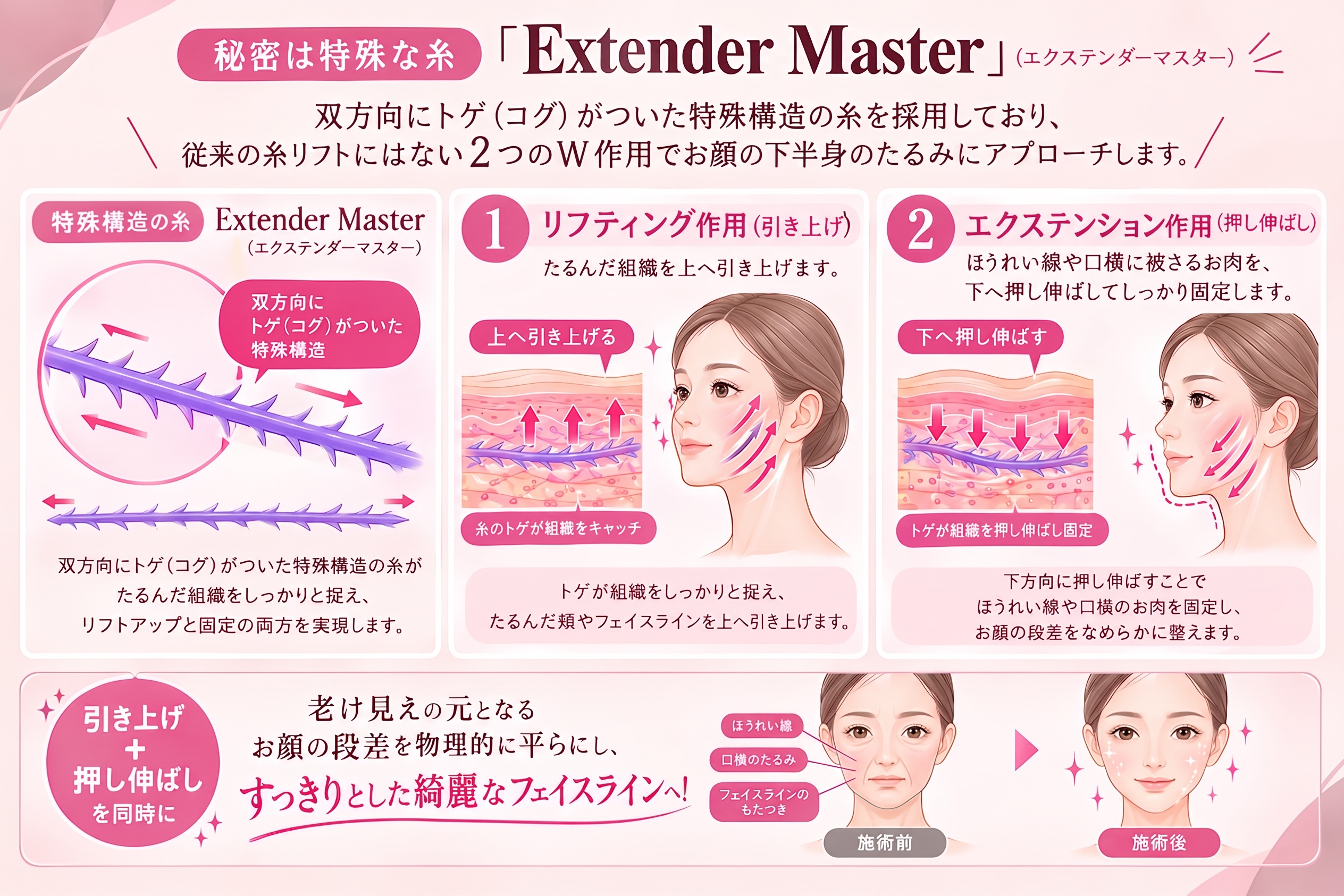 特徴とメカニズム
