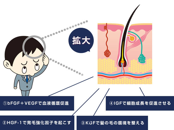 ①bFGF+VEGFで血液循環促進②HGF-1で発毛強化因子を起こす③KGFで髪の毛の環境を整える④IGFで細胞成長を促進させる