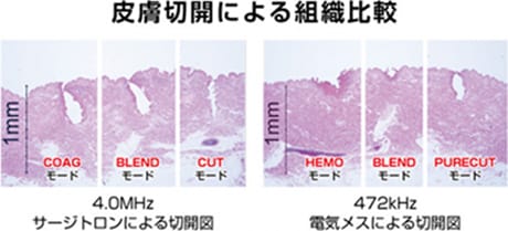 皮膚切開による組織比較