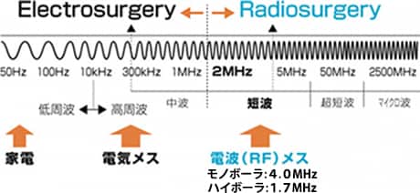 電波RFメス