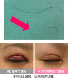 透明な糸