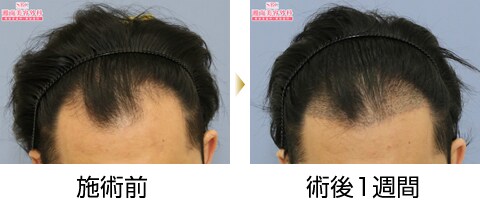 症例写真
