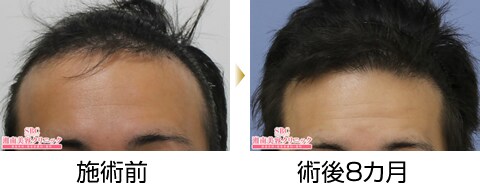 症例写真