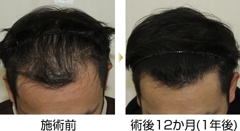 症例写真