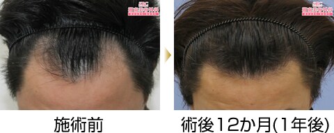 症例写真