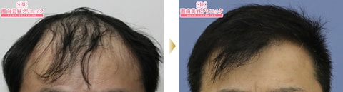 症例写真