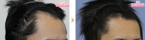症例写真