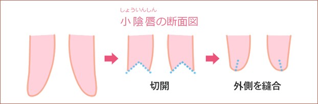 説明画像