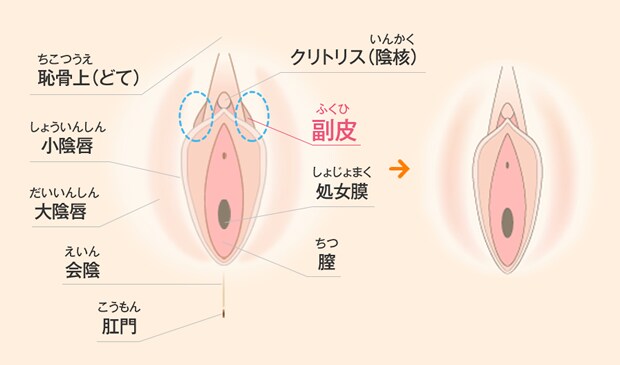 説明画像