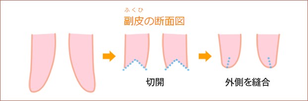 説明画像