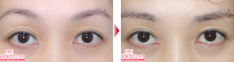 症例写真2