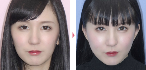 症例写真8