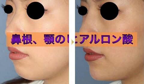 症例写真9