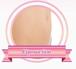 Liposuction