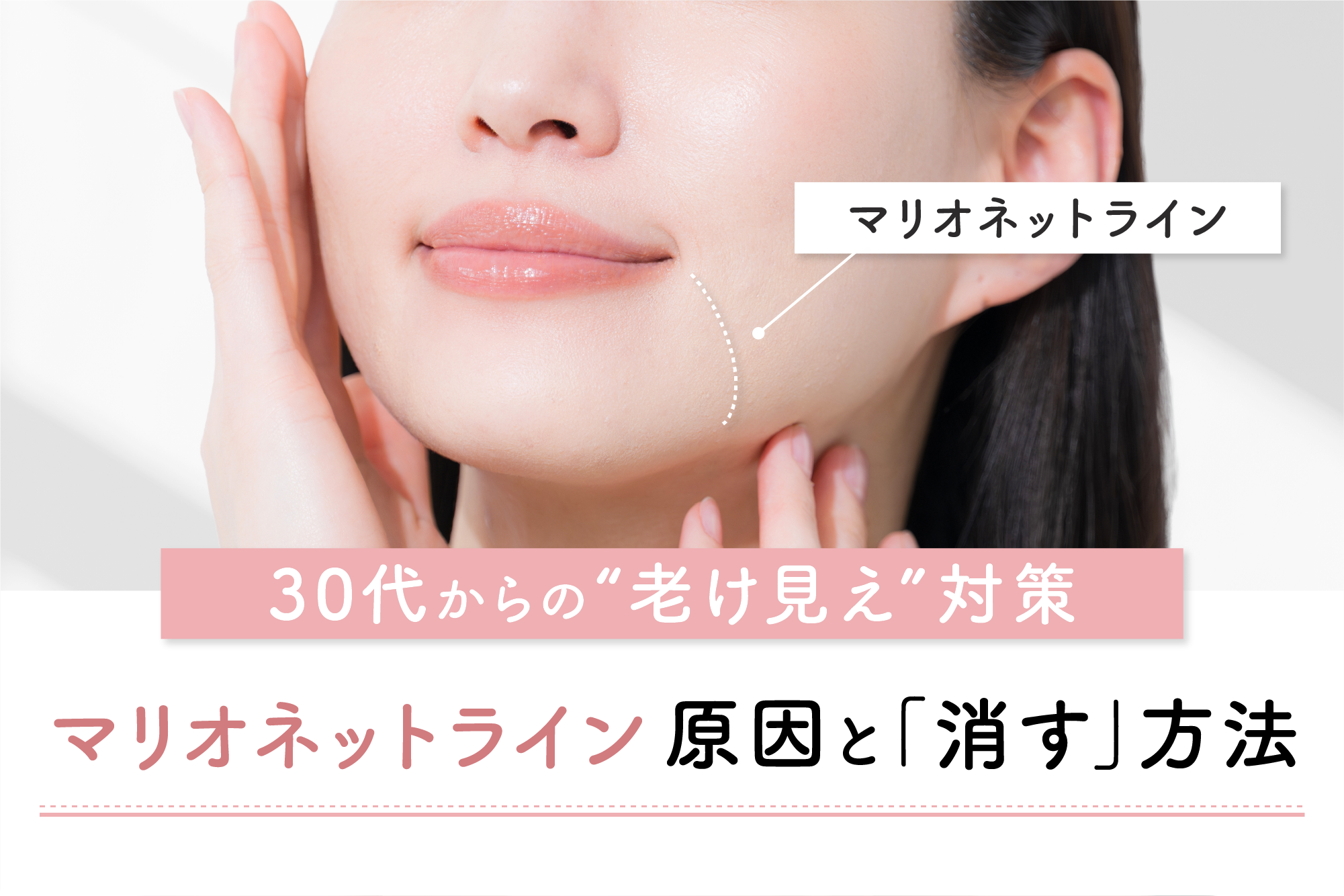 マリオ ネット ライン 即効