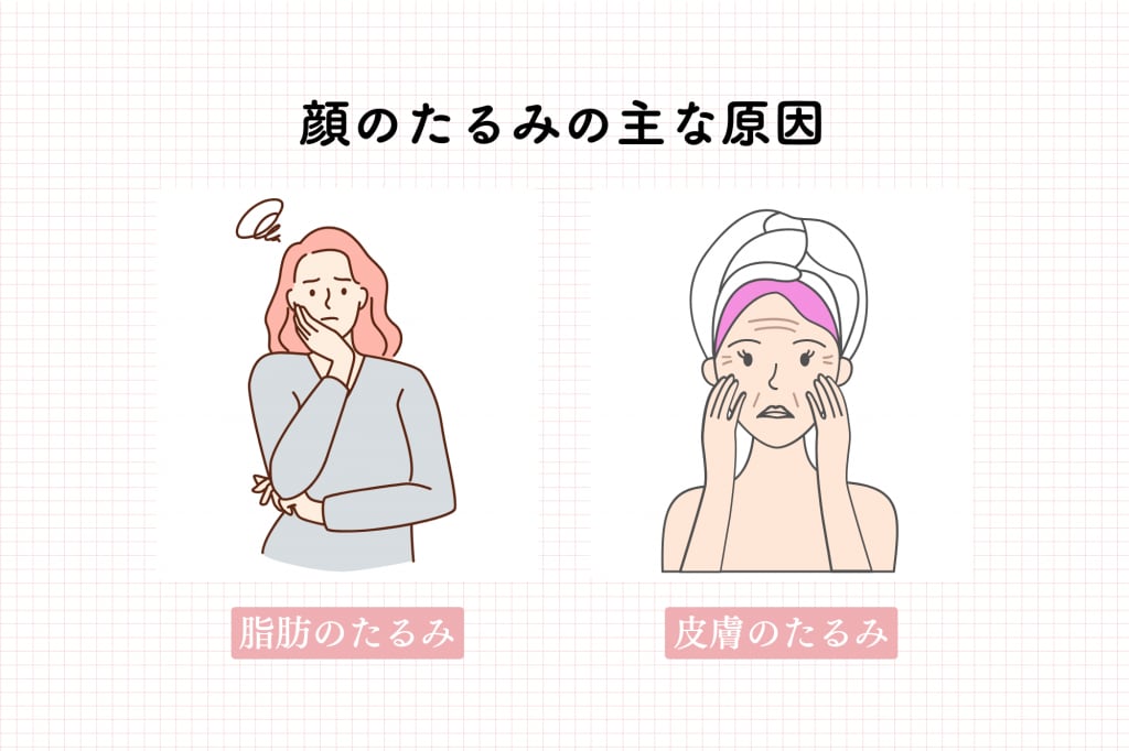 顔のたるみの主な原因_インフォグラフィック