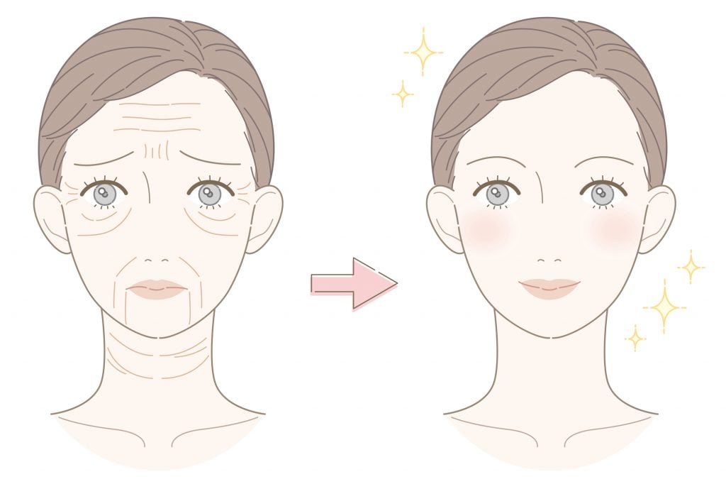 ほうれい線によるお顔のイメージ