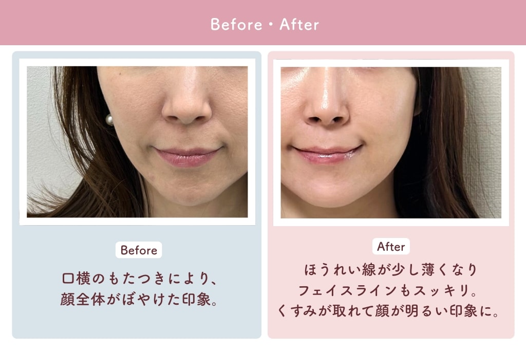 あきほさんBefore After写真