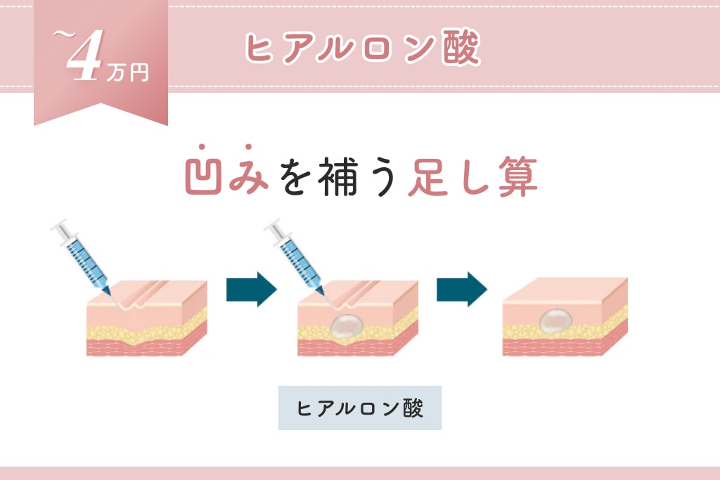 4万円ヒアルロン酸