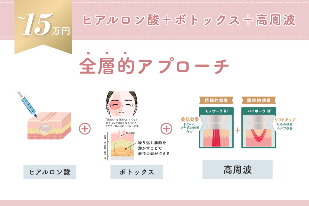 15万円 ヒアルロン酸＋ボトックス＋高周波