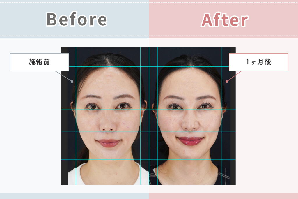 ビフォアフター