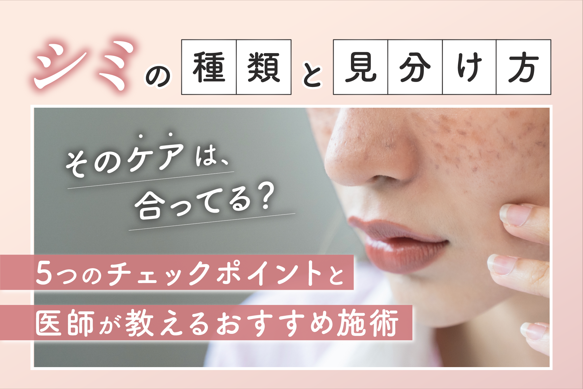 シミの種類と見分け方｜そのケアは合ってる？5つのチェックポイントと医師が教えるおすすめ施術 - FLOÉA（フロエア）