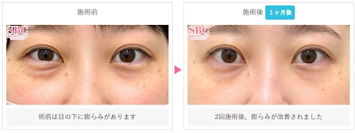 モフィウス８の症例写真