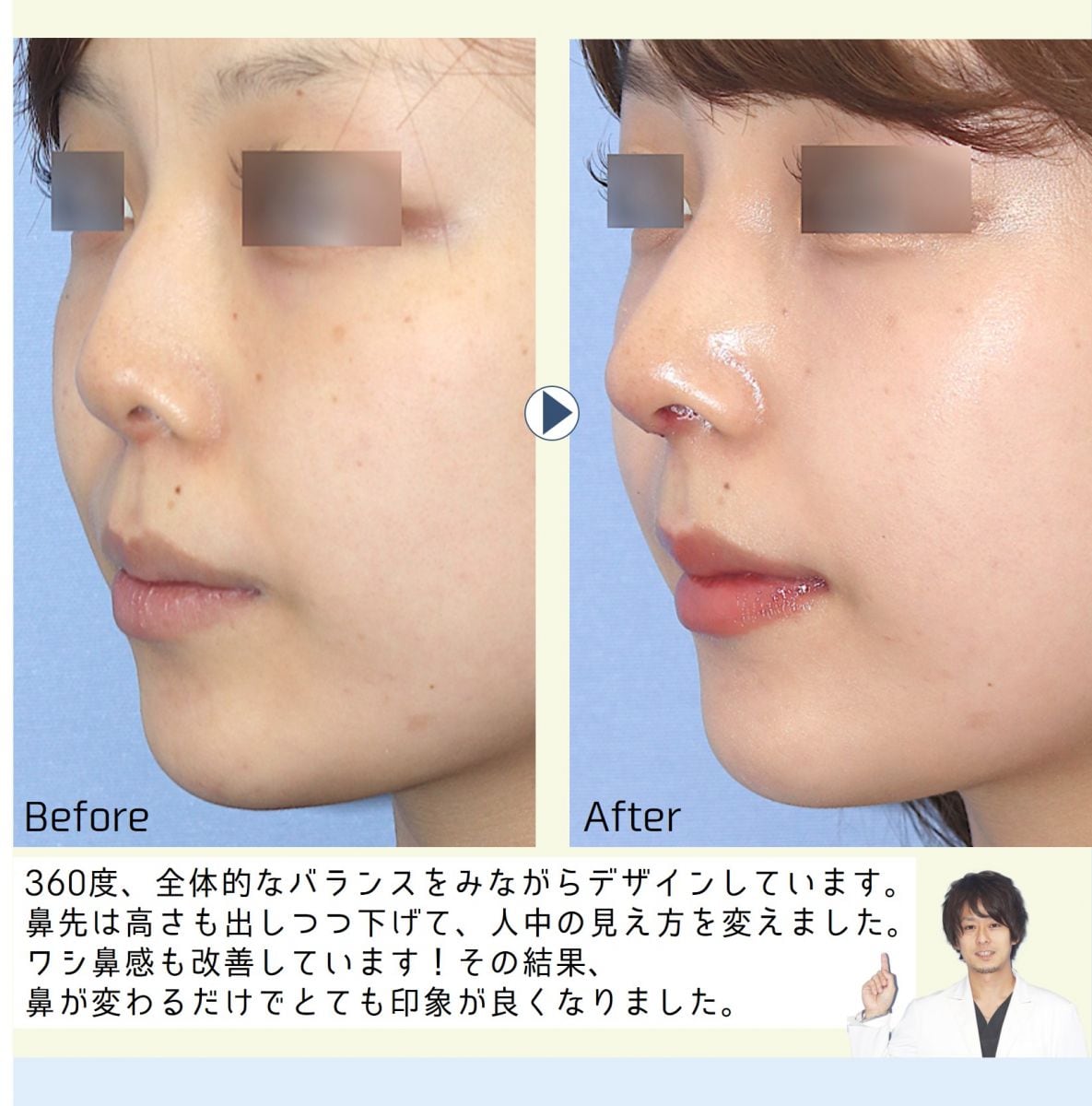 全国からインスタ指名 Dr 住田 最優 鼻整形モニター募集 美容整形 美容外科の湘南美容クリニック 全国からインスタ指名 Dr 住田 最優 鼻整形モニター募集 美容整形 美容外科の湘南美容クリニック