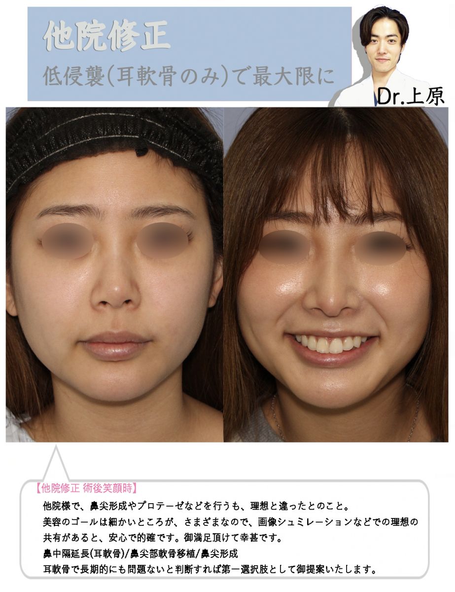 技術指導医 鼻症例数関東エリア1位の人 鼻整形モニター募集 美容整形 美容外科の湘南美容クリニック 技術指導医 鼻症例数関東エリア1位の人 鼻整形モニター募集 美容整形 美容外科の湘南美容クリニック
