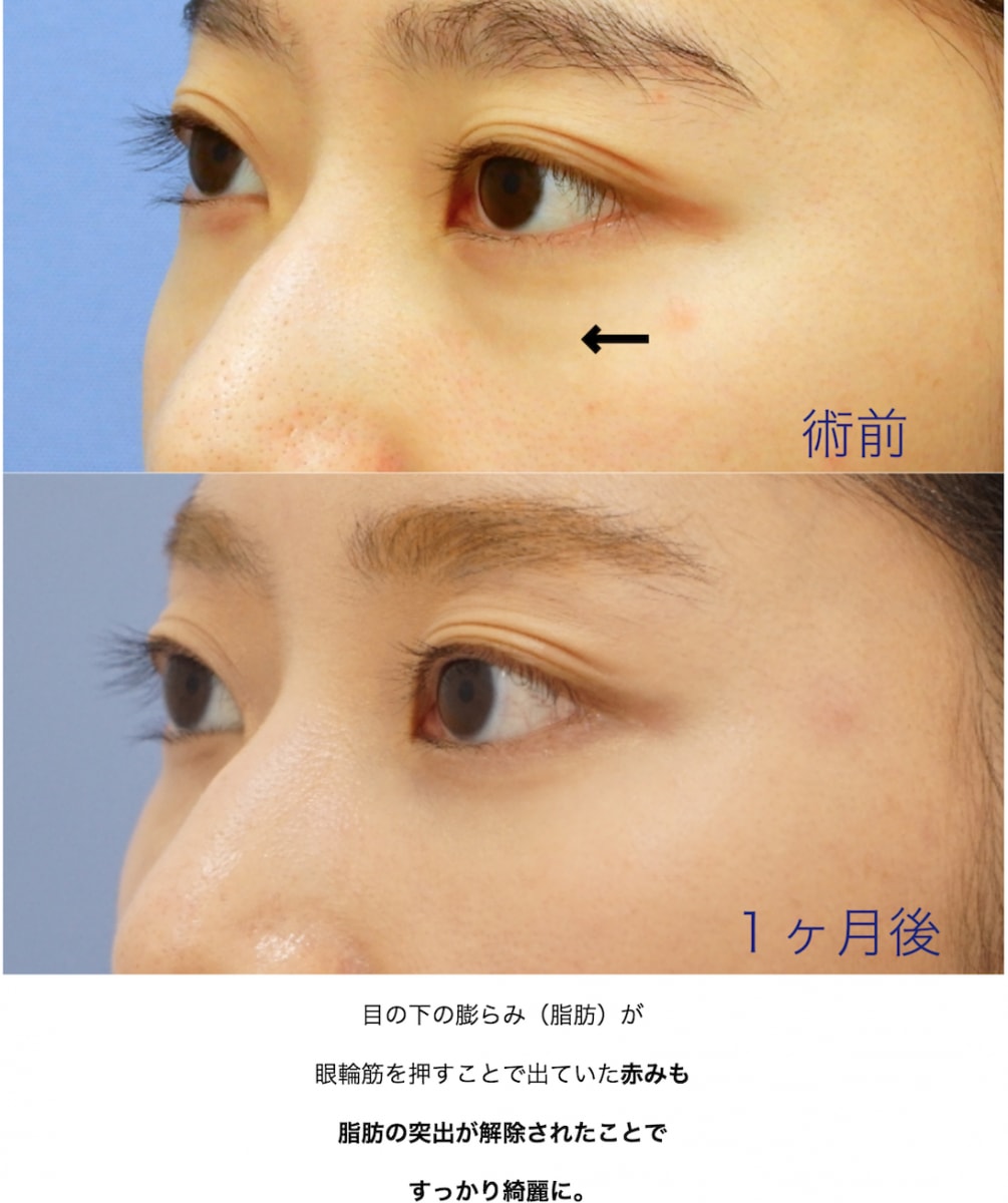 19年下半期ー年上 下半期 若返りモニター募集 美容整形 美容外科の湘南美容クリニック